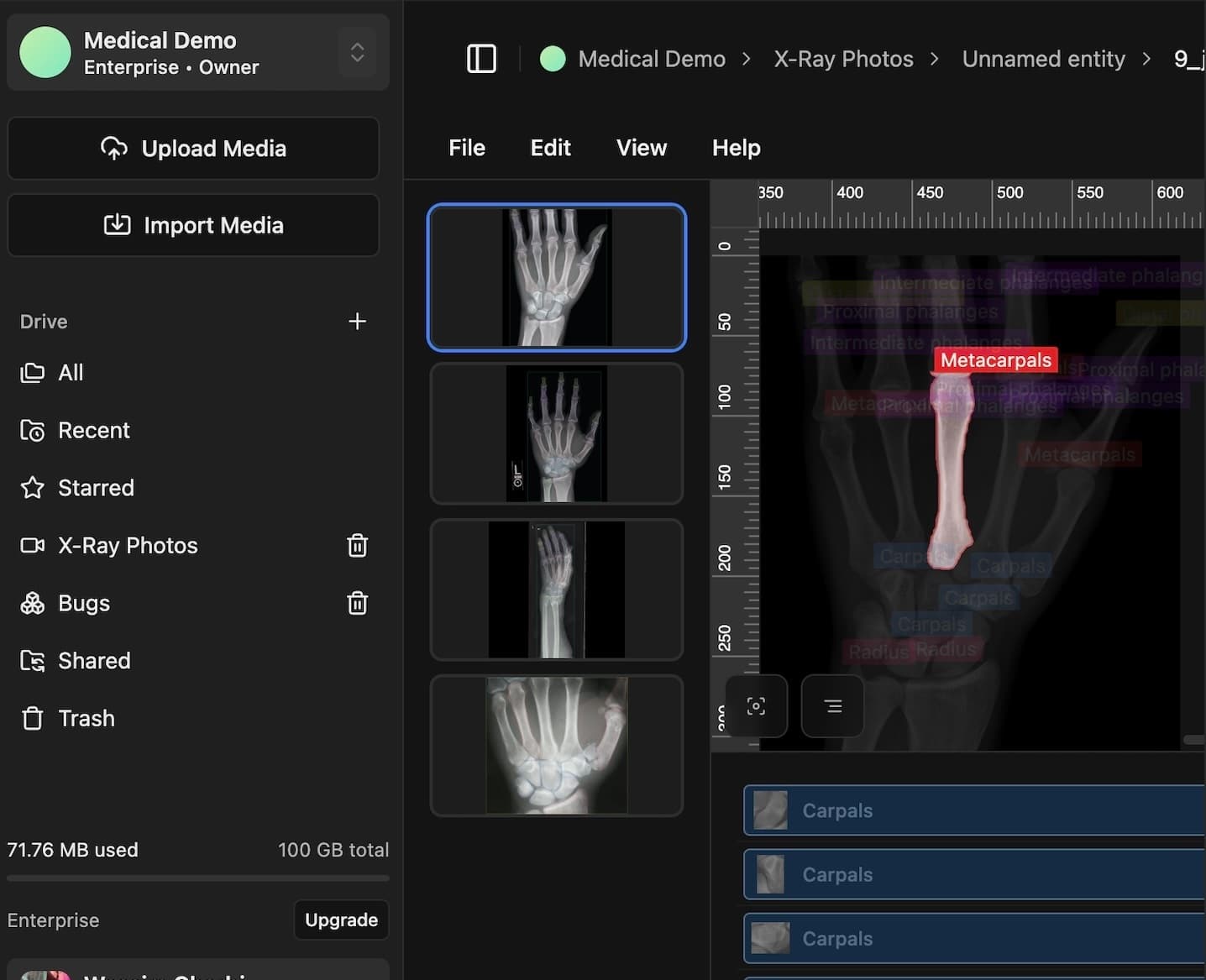 Specialized AI Models